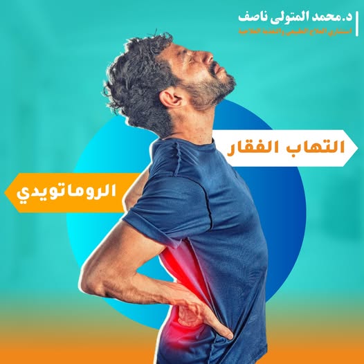 التهاب الفقار الروماتويدي